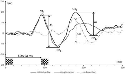 Altered Visual Cortical Excitability Is Associated With Psychopathological Symptoms in Major Depressive Disorder